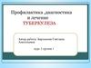 Профилактика, диагностика и лечение туберкулеза