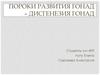 Пороки развития гонад – дисгенезия гонад