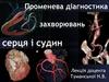 Променева діагностика захворювань серця і судин