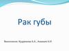 Рак губы. Заболеваемость