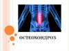 Комплекс дистрофических нарушений в суставных хрящах остеохондроз