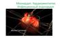 Миокардит. Кардиомиопатия. Инфекционный эндокардит