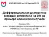 Дифференциальная диагностика элевации сегмента ST на ЭКГ на примере клинических случаев