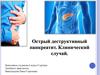 Острый деструктивный панкреатит. Клинический случай