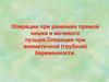 Операции при ранениях прямой кишки и мочевого пузыря. Операции при внематочной (трубной) беременности