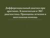 Дифференциальный диагноз при аритмиях. Клиническая и ЭКГ-диагностика. Принципы лечения и неотложная помощь