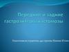 Передние и задние гастроэнтероанастомозы