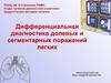 Дифференциальная диагностика долевых и сегментарных поражений легких