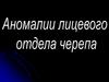 Аномалии лицевого отдела черепа