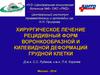 Хирургическое лечение рецидивный форм воронкообразной и килевидной деформаций грудной клетки