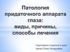 Патология придаточного аппарата глаза: виды, причины, способы лечения