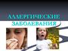 Аллергические заболевания