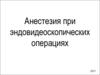 Анестезия при эндовидеоскопических операциях