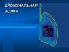 Бронхиальная астма