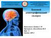 Боковой амиотрофический склероз