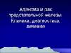 Аденома и рак предстательной железы. Клиника, диагностика, лечение