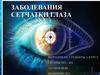 Заболевания сетчатки глаза