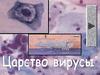 Вирусы. Общие сведения