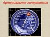 Артериальная гипертензия