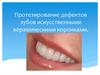 Протезирование дефектов зубов искусственными керамическими коронками