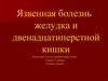 Язвенная болезнь желудка и двенадцатиперстной кишки