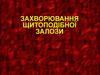Захворювання щитоподібної залози