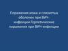 Поражения кожи и слизистых оболочек при ВИЧ-инфекции. Герпетические поражения при ВИЧ-инфекции