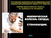 Ишемическая болезнь сердца. Стенокардия