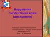 Нарушения пигментации кожи (дисхромии)