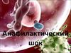 Анафилактический шок