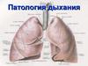 Патология дыхания