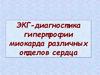ЭКГ-диагностика гипертрофии миокарда различных отделов сердца