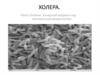 Холера. Vibrio cholerae: холерный вибрион под электронным микроскопом