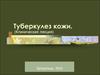 Туберкулез кожи