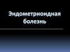 Эндометриоидная болезнь у женщин