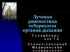Лучевая диагностика туберкулёза органов дыхания. Группы риска