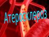 Атеросклероз – одно из самых актуальных заболеваний ХХ века