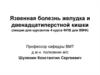 Язвенная болезнь желудка и двенадцатиперстной кишки
