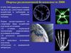 Лекция №10 РБ. Нормы радиационной безопасности 2000