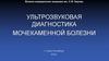 Ультрозвуковая диагностика мочекаменной болезни
