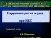 Нарушения ритма при ишемической болезни сердца (ИБС)