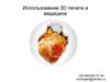Использование 3D печати в медицине