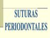 Suturas periodontales