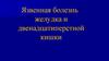 Язвенная болезнь желудка и ДПК (2)