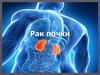 Рак почки