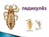 Педикулёз ( биттеу)- бұл тері мен шаштың паразитарлы ауруы