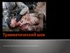Травматический шок