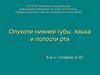 Опухоли нижней губы, языка и полости рта