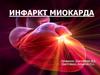 Инфаркт миокарда