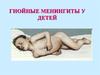 Гнойные менингиты у детей